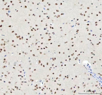 Anti-TARDBP / TAR DNA binding protein / TDP43