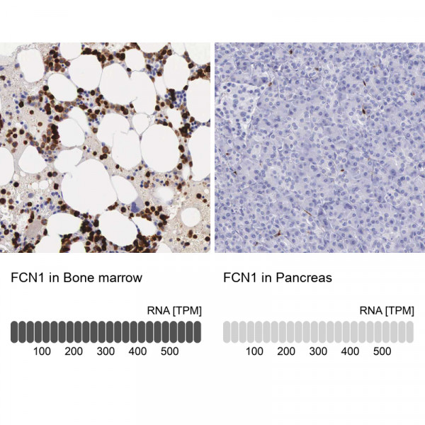 Anti-FCN1