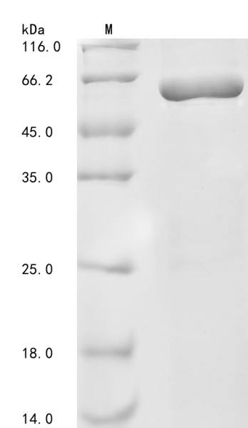 Neurofilament light polypeptide (NEFL), human, recombinant