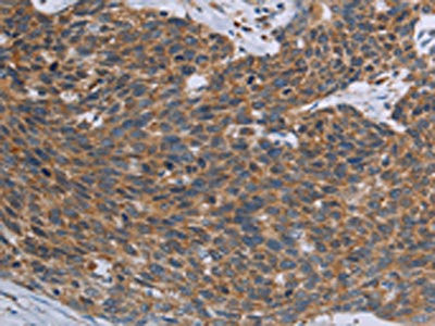 Anti-TNPO1