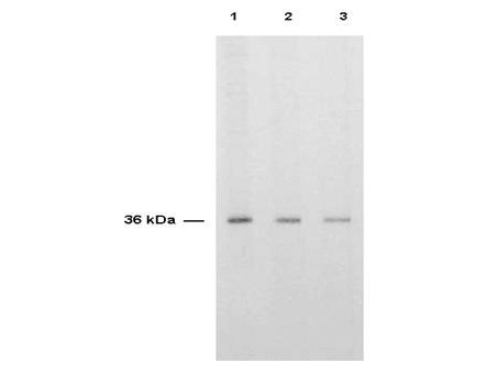 Anti-Thymidylate Synthase (TS), human