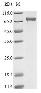 ATP-dependent DNA helicase Q1 (RECQL), human, recombinant