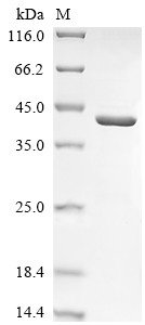 Ceroid-lipofuscinosis neuronal protein 5 (CLN5), human, recombinant