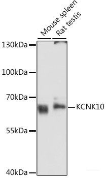 Anti-KCNK10