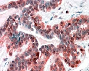 Anti-SNX12, C-terminal