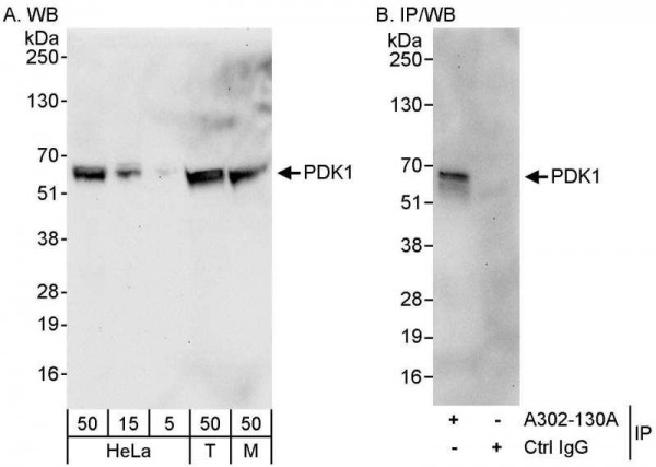 Anti-PDK1