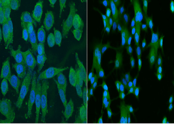 Anti-ALDH1/ALDH1A1/ALDC Monoclonal Antibody