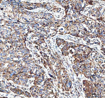 Anti-MUT / Methylmalonyl-CoA mutase