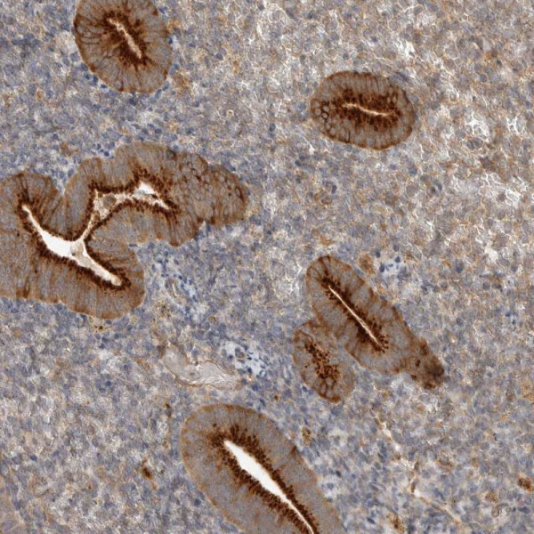 Anti-ZNF232