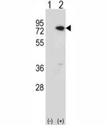 Anti-MeCP2