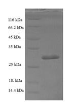 Activated RNA polymerase II transcriptional coactivator p15 (SUB1), human, recombinant