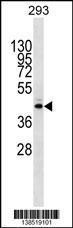 Anti-METTL2B, NT (METTL2B, Methyltransferase-like protein 2B)