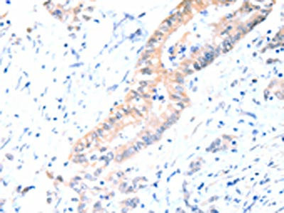 Anti-ACAD10