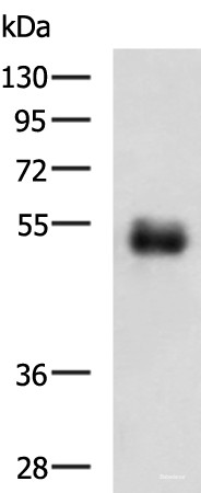 Anti-METTL17