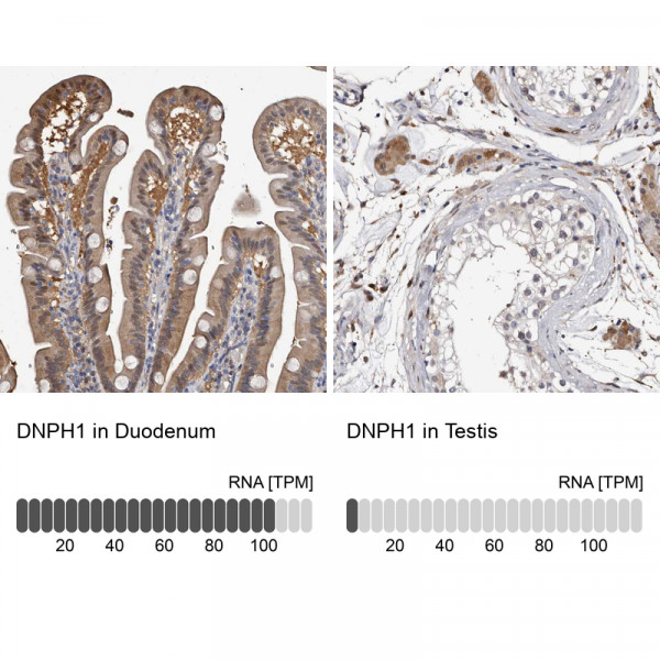 Anti-DNPH1