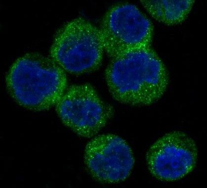 Anti-ATG5