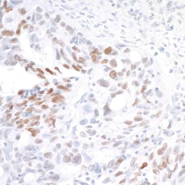 Anti-IRF1 Recombinant Monoclonal