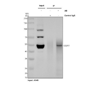 Anti-EGLN1 / Egl nine homolog 1 / PHD2