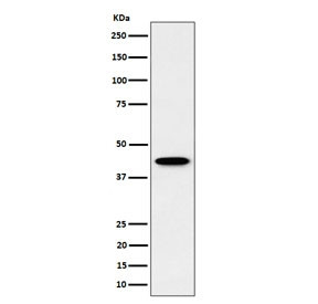 Anti-Inositol-tetrakisphosphate 1-kinase / ITPK1, clone 29I50
