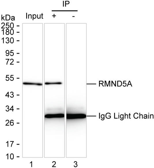 Anti-RMND5A