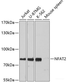 Anti-NFATC1