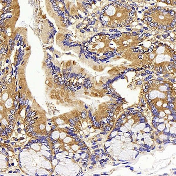 Anti-CD13