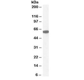 Anti-Catalase