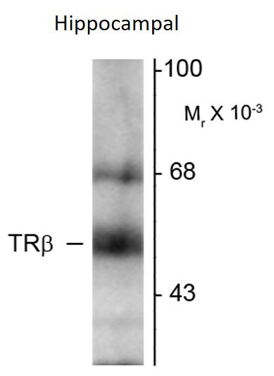 Anti-Thyroid Hormone Receptor beta, clone 2386