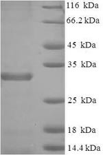 Baculoviral IAP repeat-containing protein 5 (Birc5), mouse, recombinant