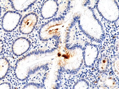 Anti-Helicobacter pylori, Rabbit Monoclonal (RM400)