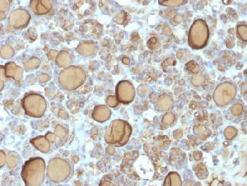 Anti-Thyroglobulin (Thyroidal Cell Marker) Recombinant Rabbit Monoclonal Antibody (clone:TGB/1970R)