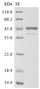 Tropomyosin, Anisakis simplex, recombinant