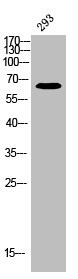 Anti-Phospho-ESR1 (S118)