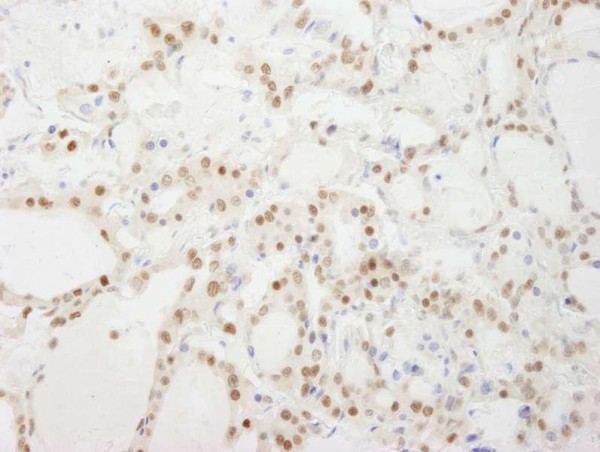 Anti-GTF3C4/TFIII1C90 IHC Antibody, affinity purifie (IHC)