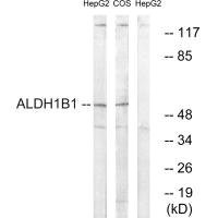 Anti-ALDH1B1