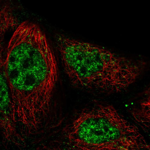 Anti-RASGRP3