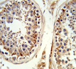 Anti-Integrin beta 3