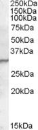 Anti-PGRP-S, C-terminal