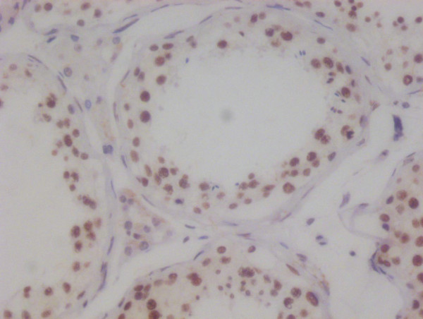 Anti-KAT8 Recombinant Monoclonal, clone 7E11