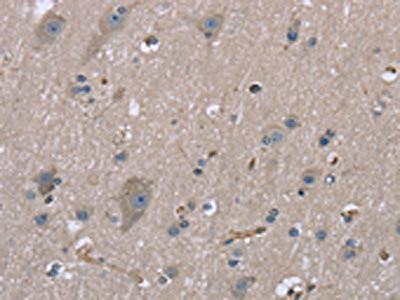 Anti-MYL12B
