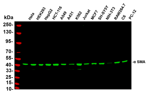Anti-Recombinant alpha smooth muscle actin, clone 2B8