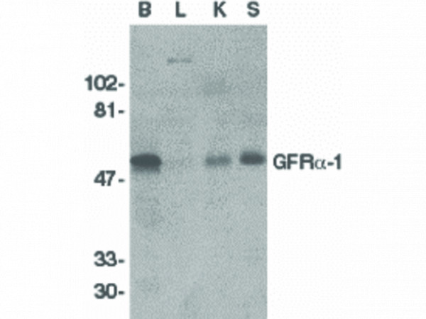 Anti-GFR alpha 1