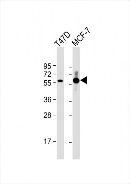 Anti-Estrogen Receptor alpha