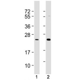 Anti-RAB7L1, clone 1789CT823.71.1.1