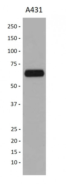 Anti-TCF7L1 / TCF3