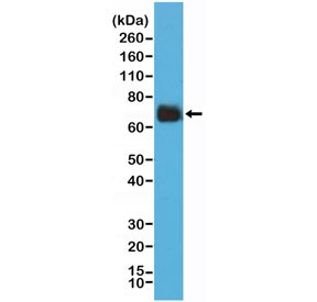 Anti-Cyclooxygenase 2 / COX2 / PTGS2 (recombinant antibody), clone RM348