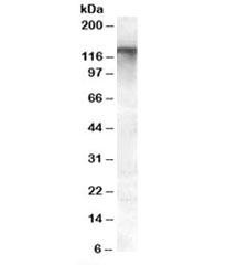 Anti-MRP8