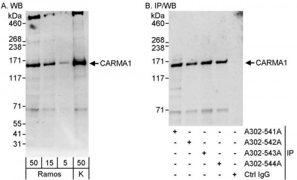 Anti-CARMA1