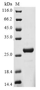 Coiled-coil domain-containing protein 112 (CCDC112), partial, human, recombinant