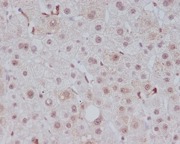 Anti-Heme Oxygenase 1 / HMOX1, clone AEG-8